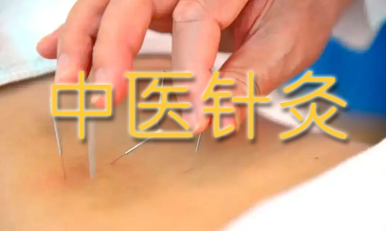 中医针灸